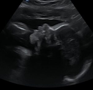 ZorgWonder.nl pretecho echo 2d 1 profiel